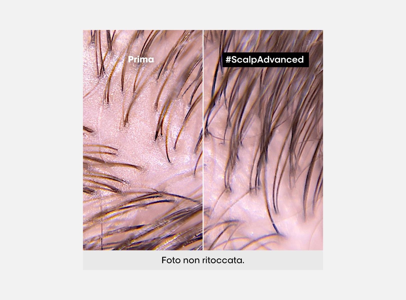 L'Oreal Shampoo Cute Grassa Scalp Advance Serie Expert 300ML